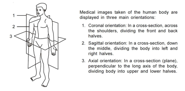 MRI scanning planes MRI scanning planes