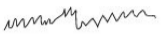 EEG wave during awake and alert EEG wave during awake and alert