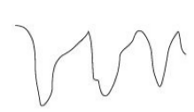 EEG wave during deep sleep EEG wave during deep sleep