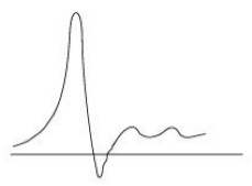EMG waveform EMG waveform