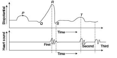 Heart sounds Heart sounds